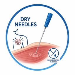 Dry Needles